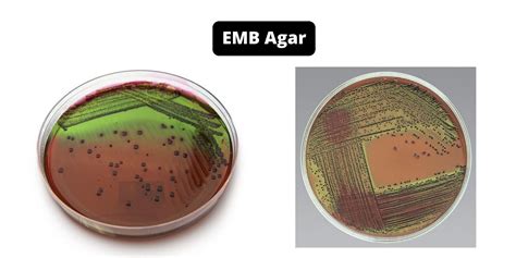 EMB Agar : Principle, Composition, Uses and Interpretation.